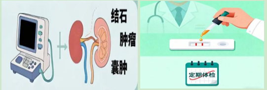 尿“隐血”阳性？别慌！它只…
